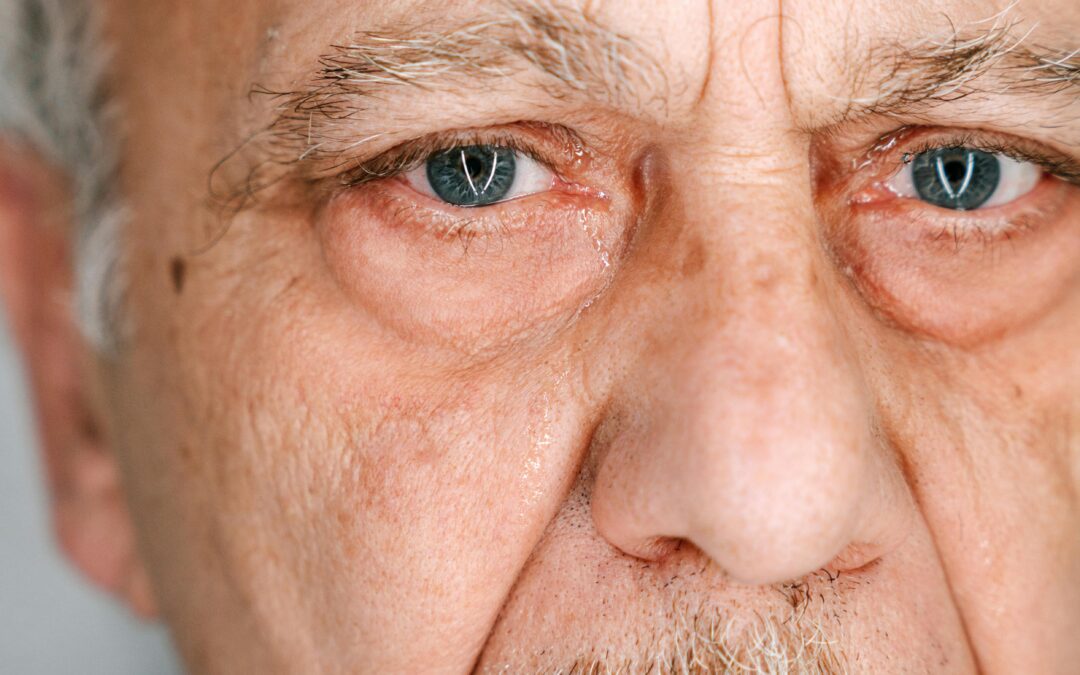 Macular Degeneration Exam